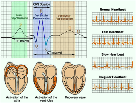 Basic Facts About EKG/ECG Monitor That You Don't Know