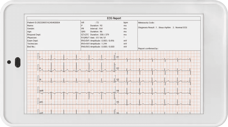 Preview and export the Pocket ECG report